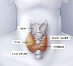 Tiroid Hastalıkları 2 - Op. Dr. Selçuk Kihtir